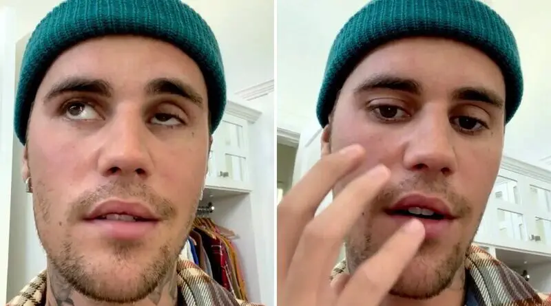 Justin Bieber provides an update on his facial paralysis